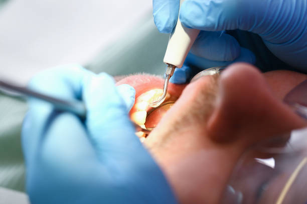 Best Weekend Emergency Dental Services in Clarendon, TX