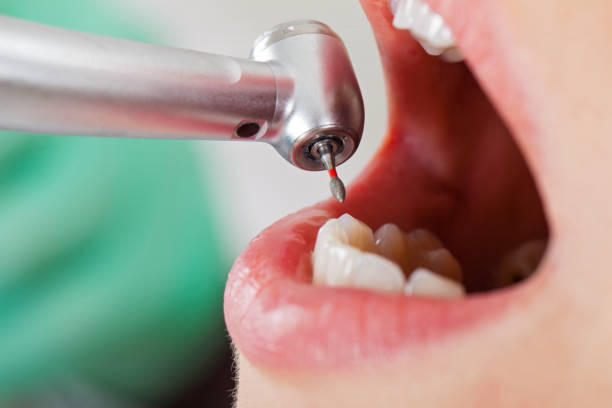 Best Emergency Dental Care for Sports Injuries in Clarendon, TX